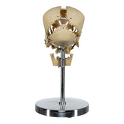 Real Human Exploded Skull on Stand