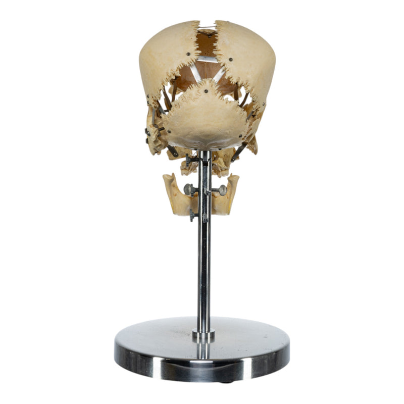 Real Human Exploded Skull on Stand