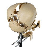 Real Human Exploded Skull on Stand