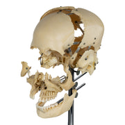 Real Human Exploded Skull on Stand