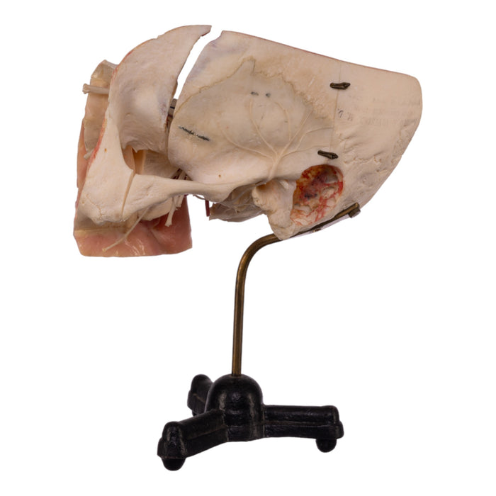 Real Human Partial Skull on Stand
