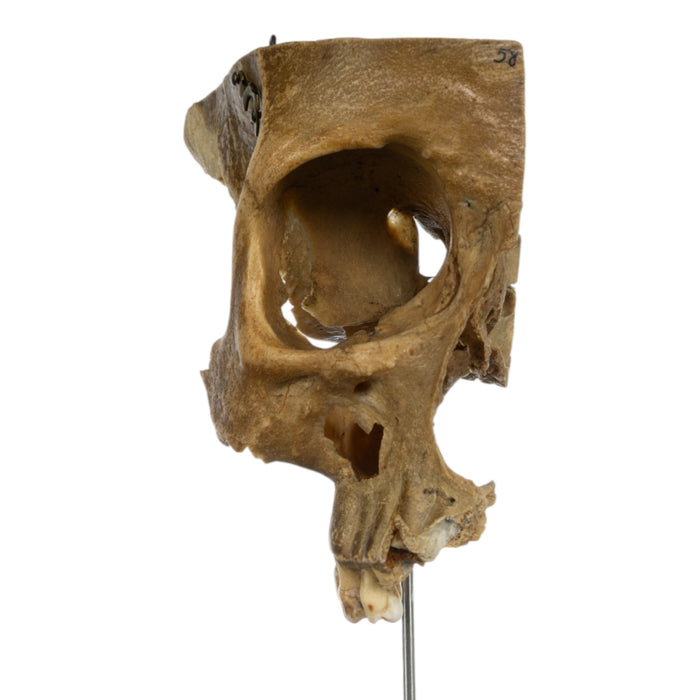 Real Human Partial Skull on Stand
