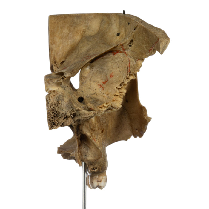 Real Human Partial Skull on Stand