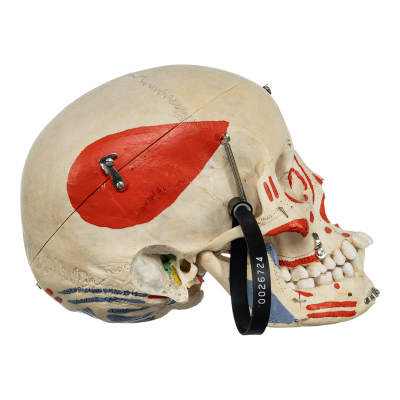 Real Human Skull - Dissected