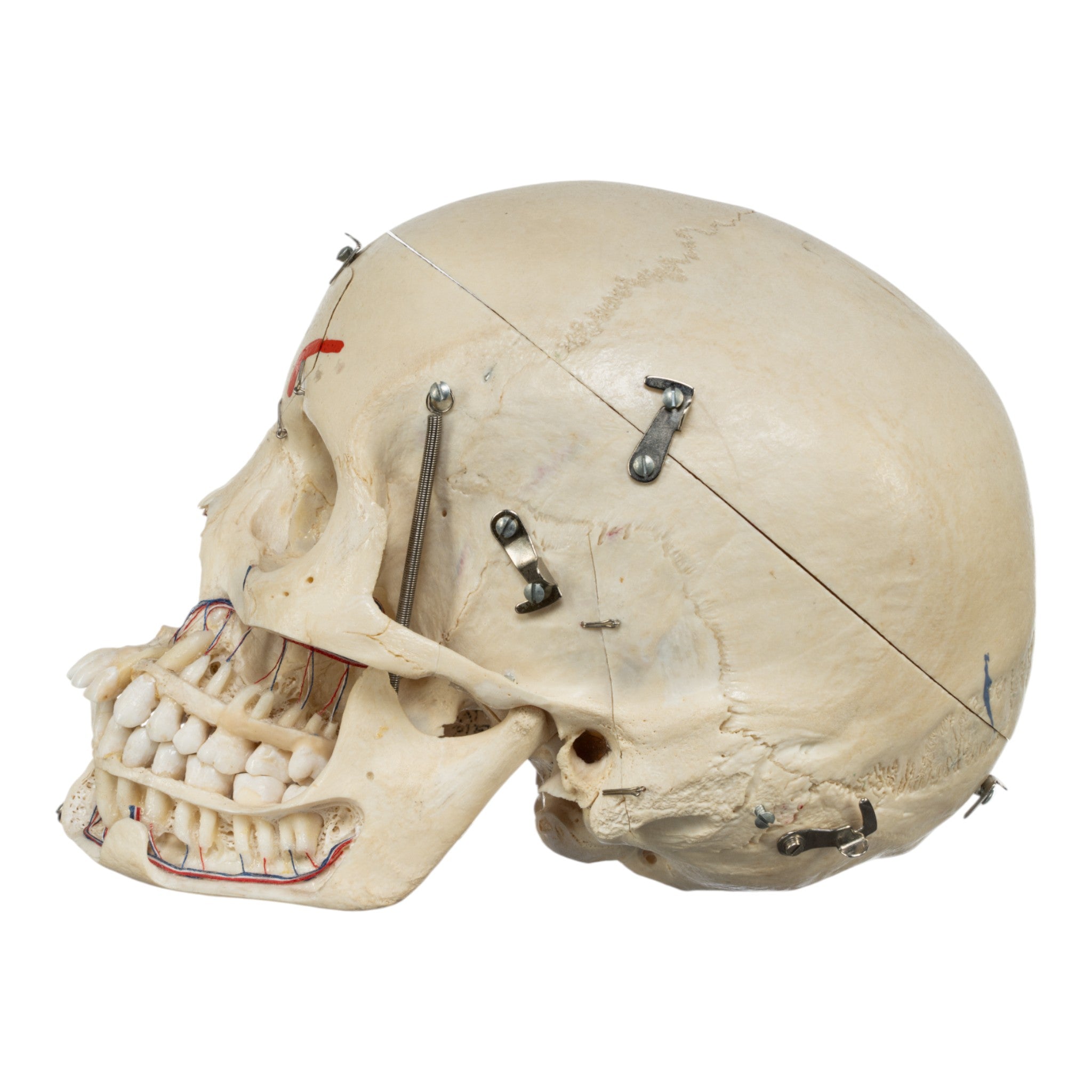 Real Dissected Human Skull For Sale — Skulls Unlimited