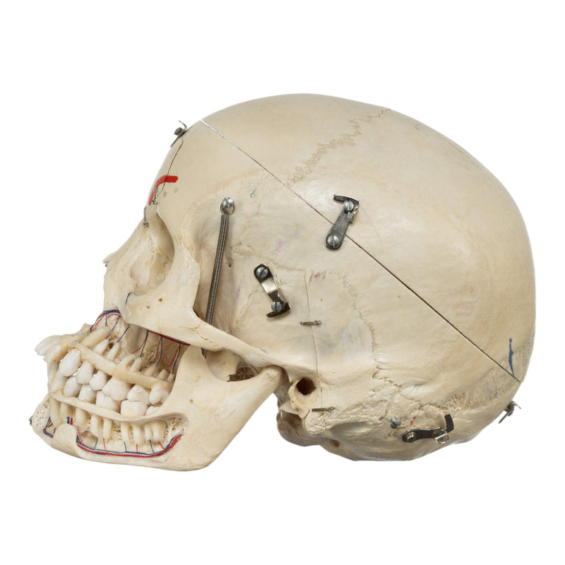 Real Human Skull - Dissected