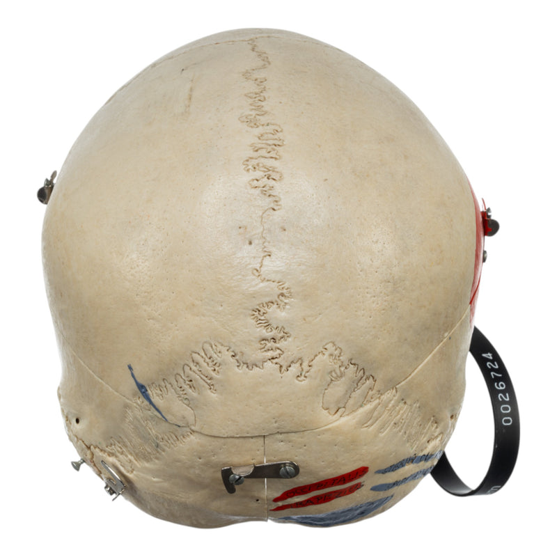 Real Human Skull - Dissected