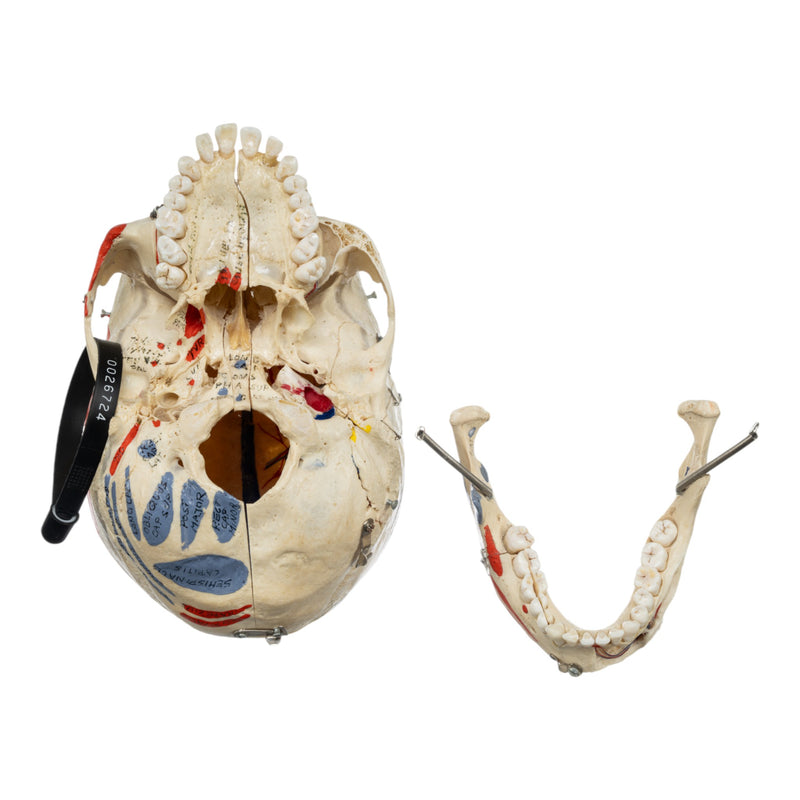Real Human Skull - Dissected