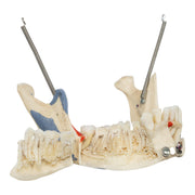 Real Human Skull - Dissected