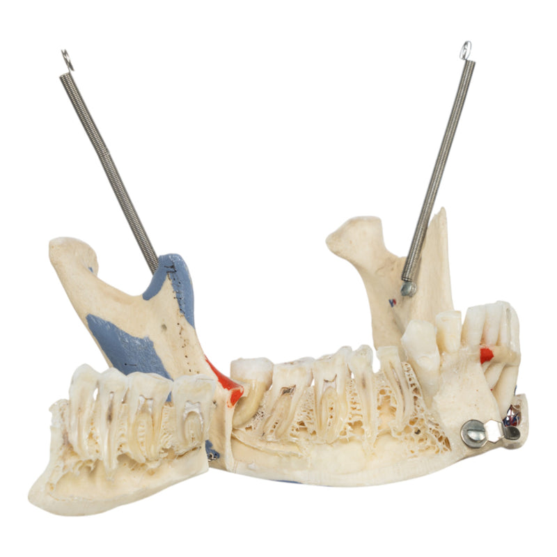 Real Human Skull - Dissected