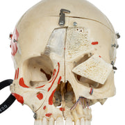 Real Human Skull - Dissected