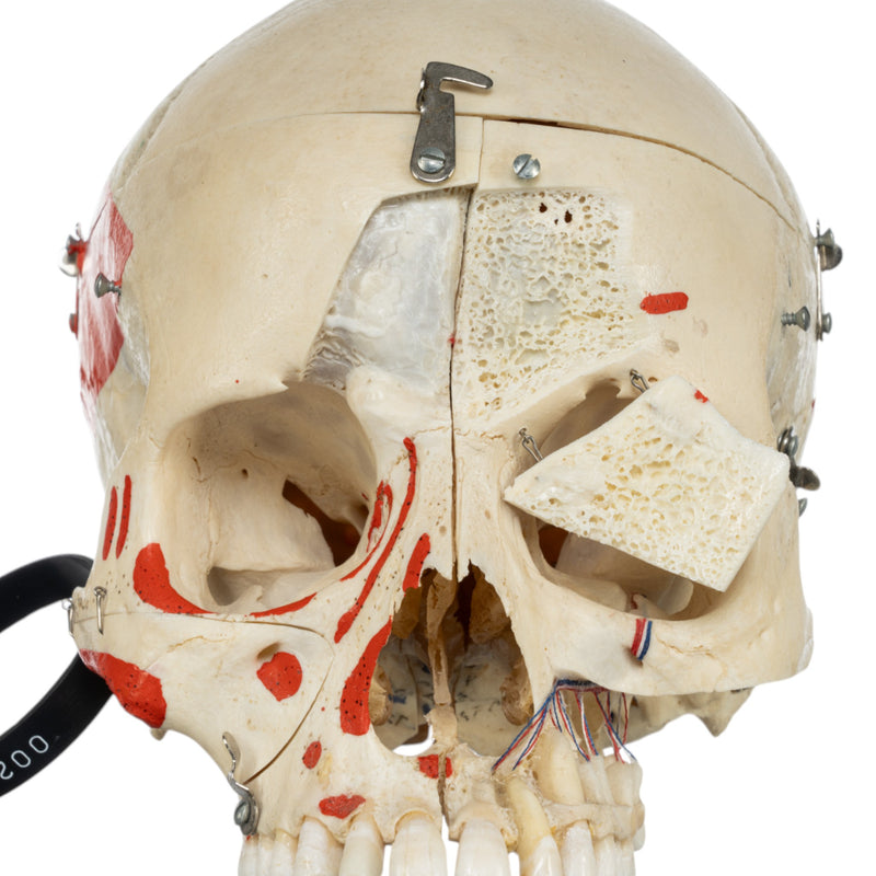 Real Human Skull - Dissected