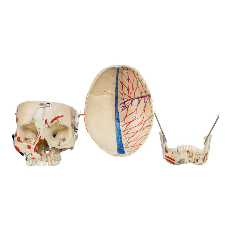 Real Human Skull - Dissected
