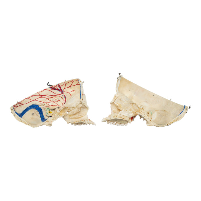 Real Human Skull - Dissected