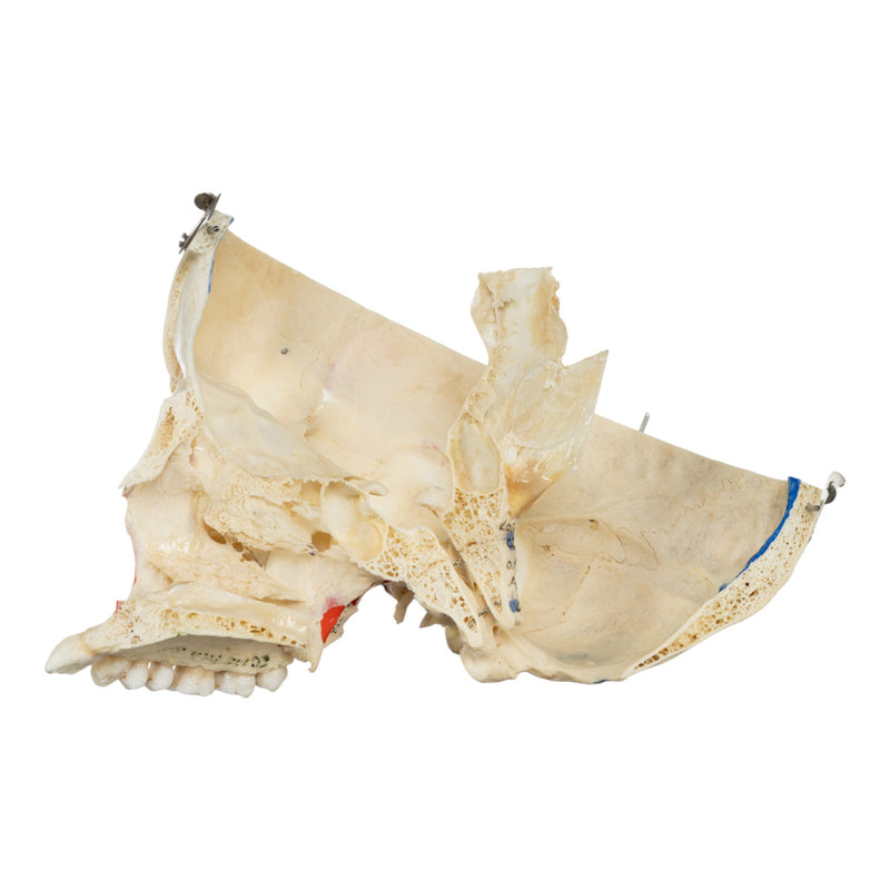 Real Human Skull - Dissected