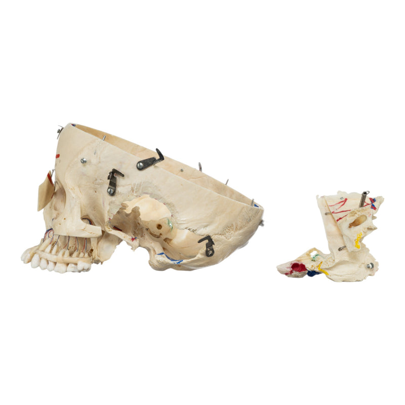 Real Human Skull - Dissected