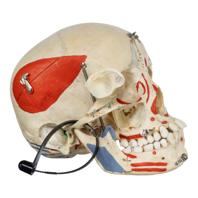 Real Human Skull - Dissected