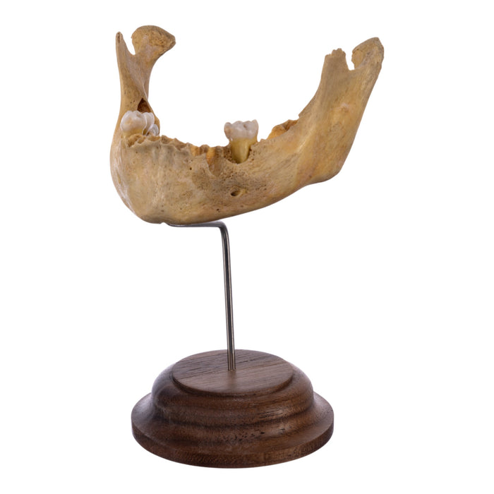 Real Human Mandible on Stand - Young