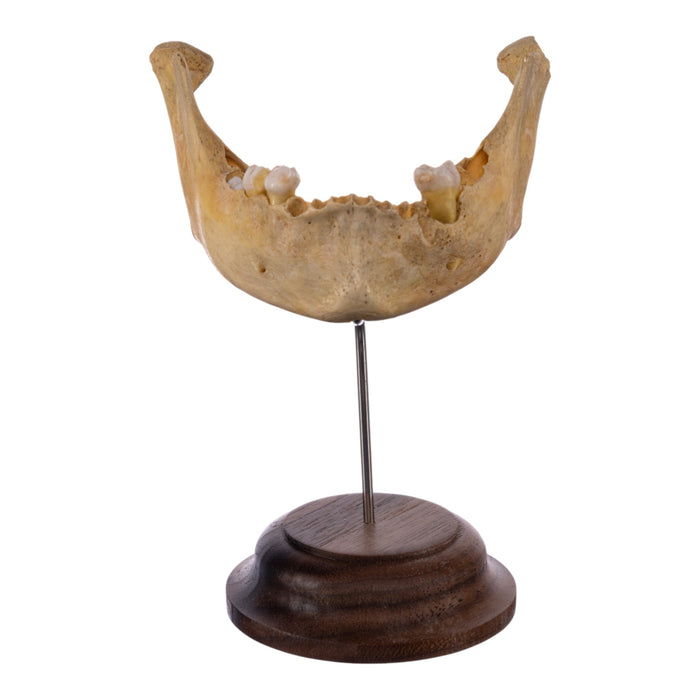 Real Human Mandible on Stand - Young