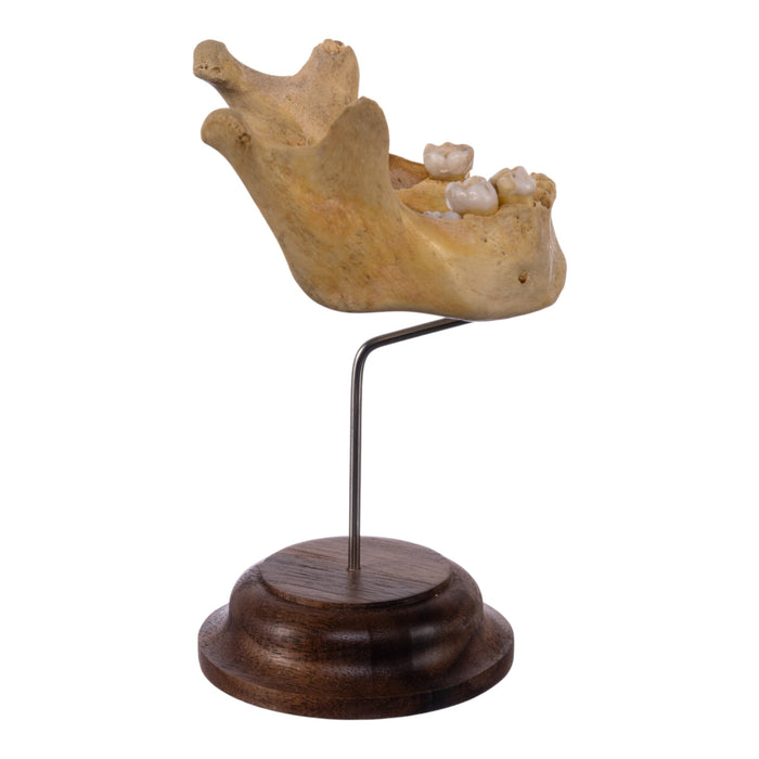 Real Human Mandible on Stand - Young