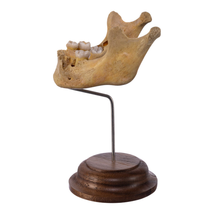 Real Human Mandible on Stand - Young