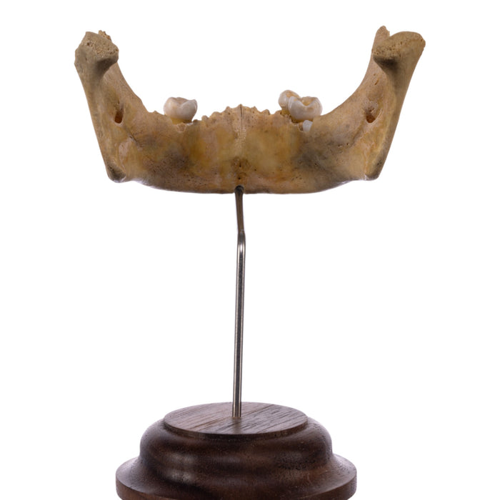 Real Human Mandible on Stand - Young
