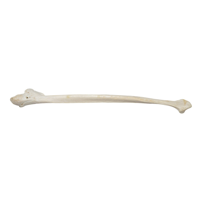 Real Human Fibula - Pathology