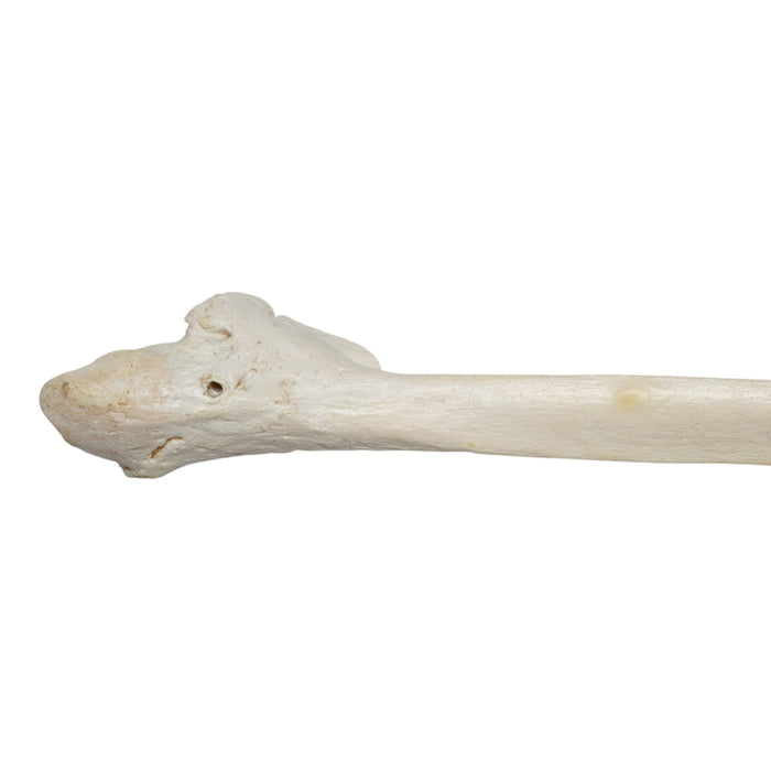 Real Human Fibula - Pathology