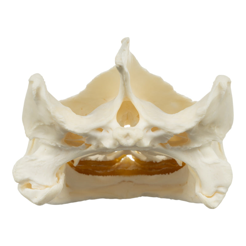 Real Snapping Turtle Skull - Pathology