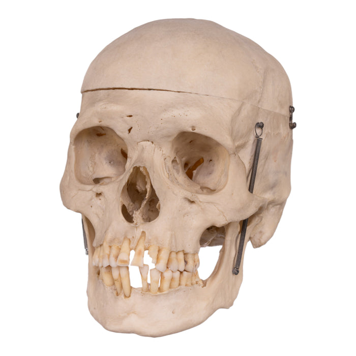 Real Human Skull
