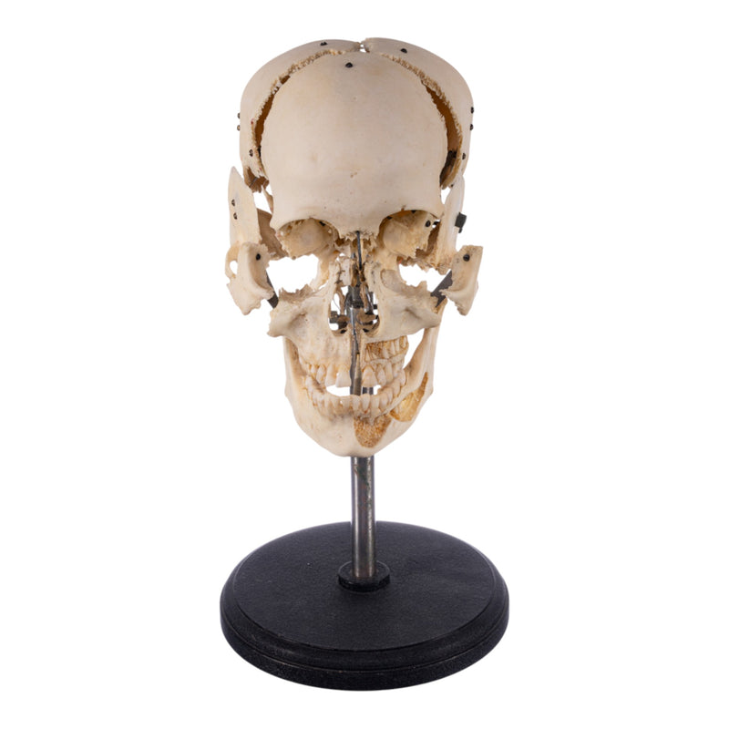 Real Human Exploded Skull on Stand