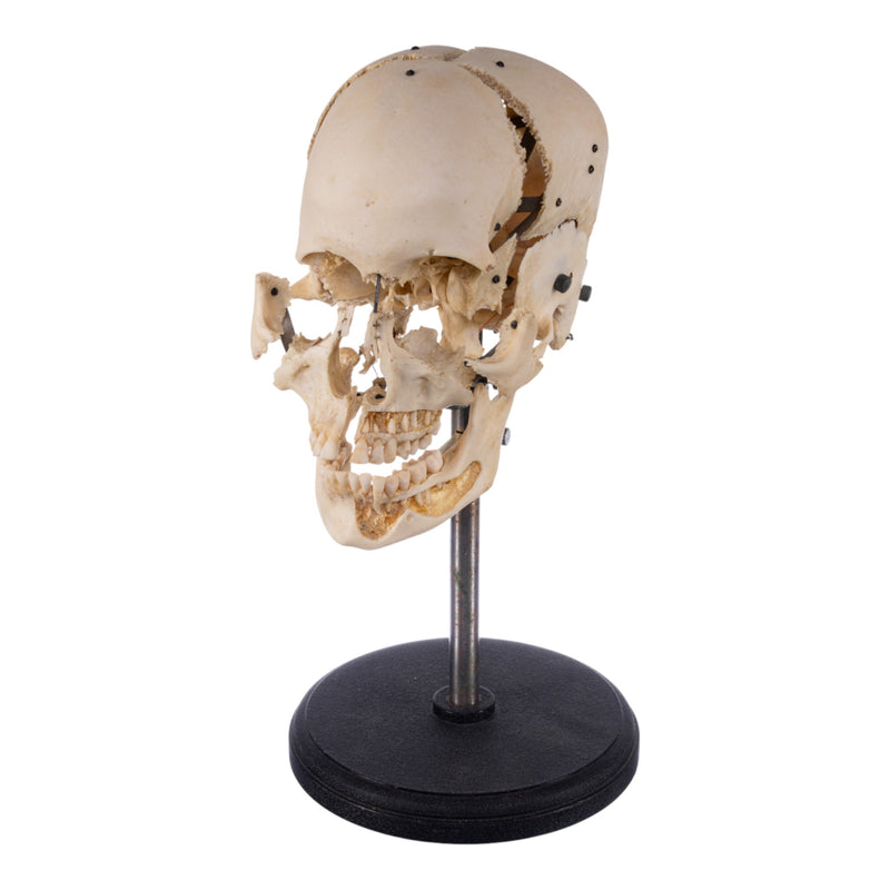 Real Human Exploded Skull on Stand