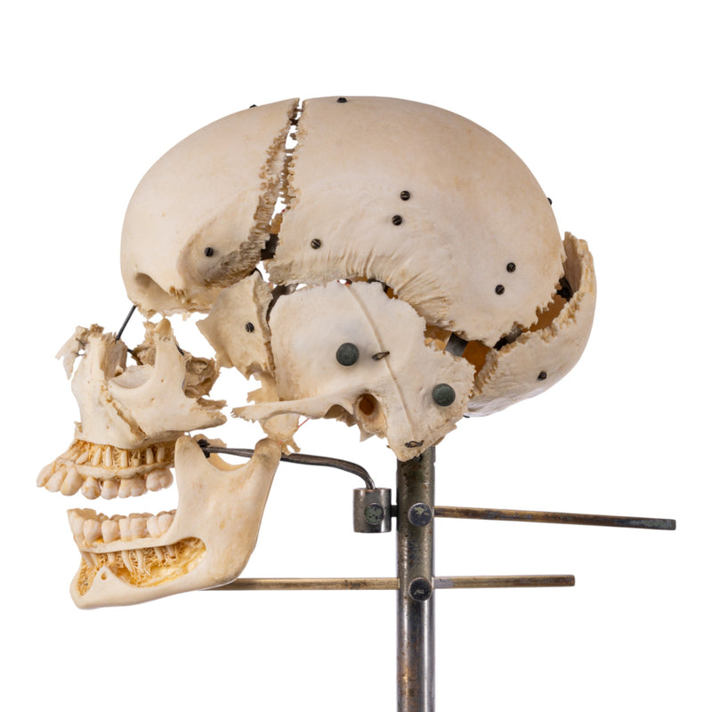 Real Human Exploded Skull on Stand