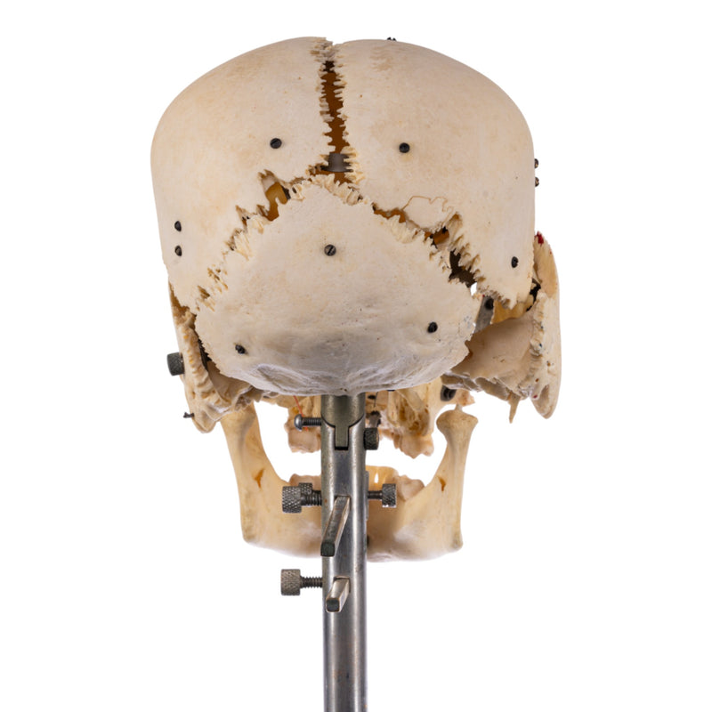 Real Human Exploded Skull on Stand