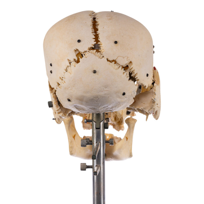 Real Human Exploded Skull on Stand
