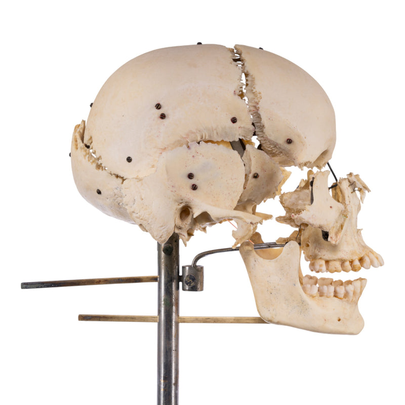 Real Human Exploded Skull on Stand