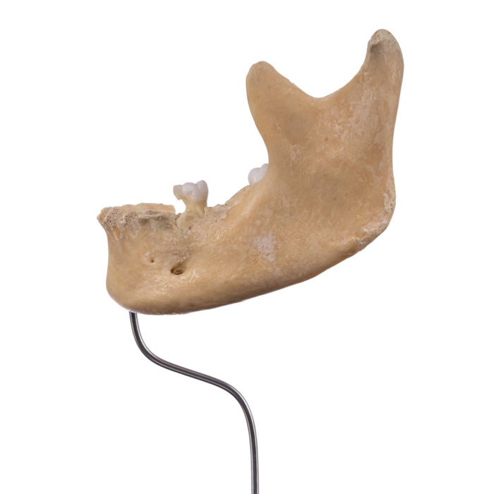 Real Human Partial Mandible On Stand