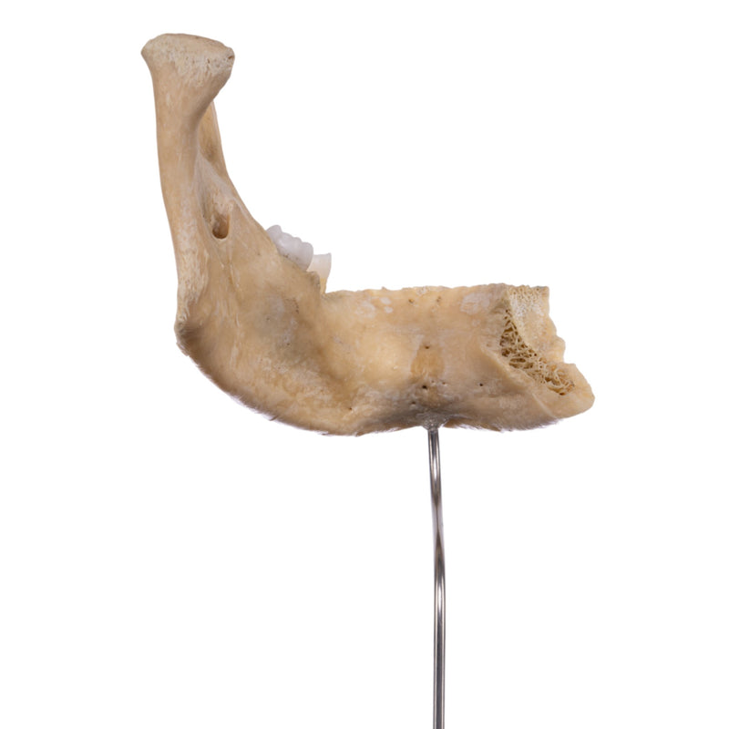 Real Human Partial Mandible On Stand