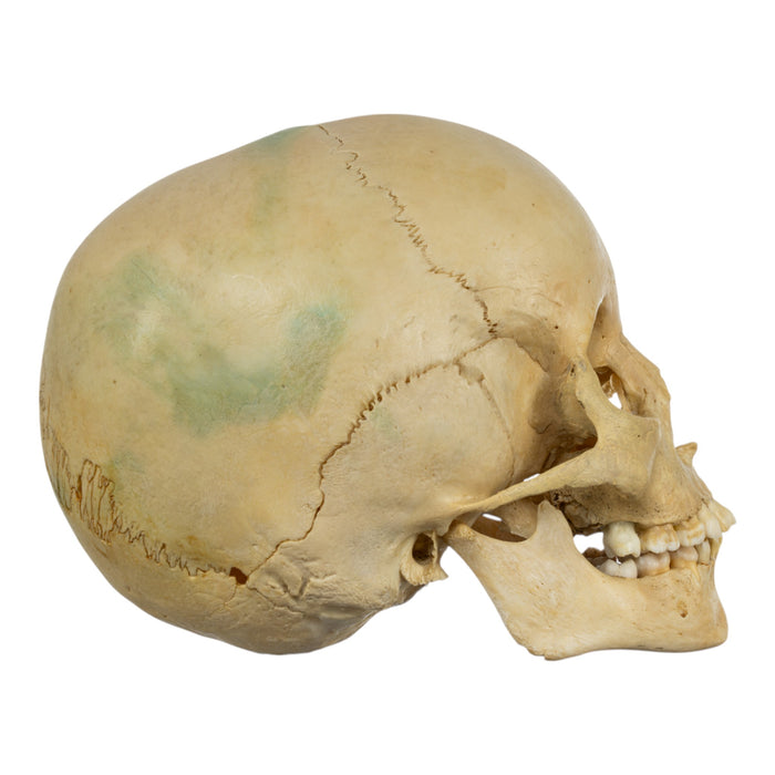 Real Human Child Skull
