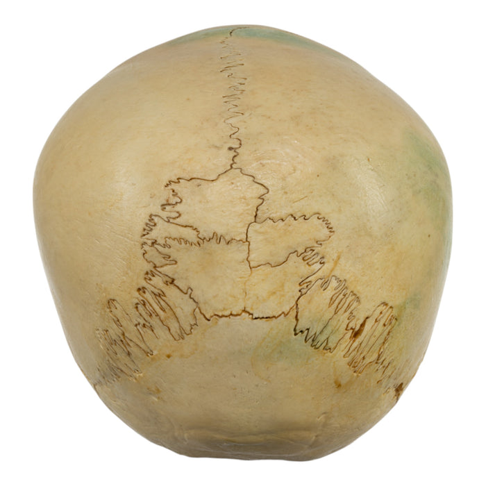 Real Human Child Skull