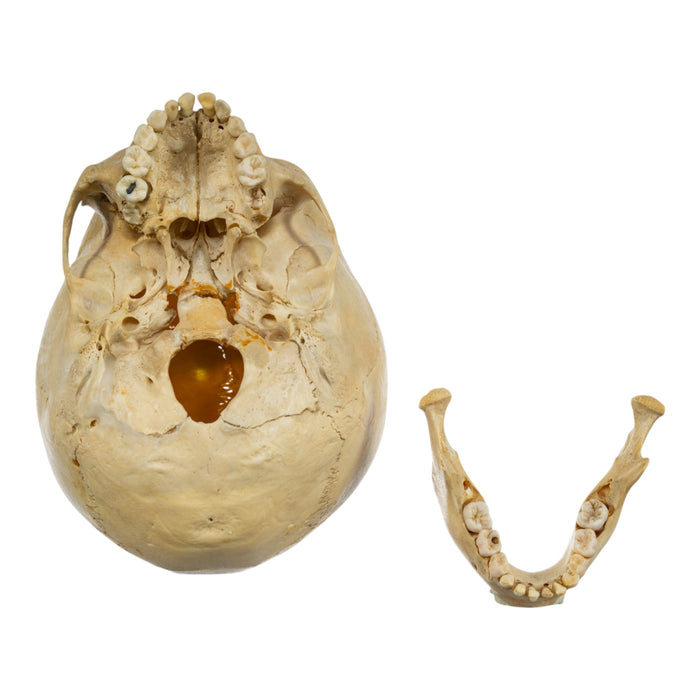 Real Human Child Skull