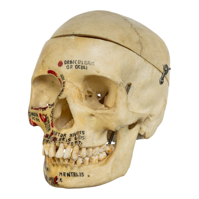Real Human Painted Skull in Carrying Case