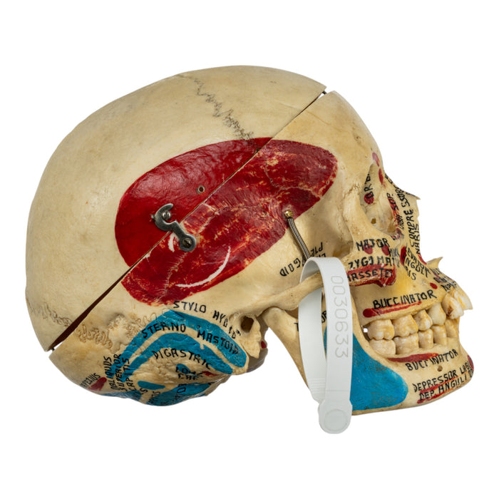 Real Human Painted Skull in Carrying Case