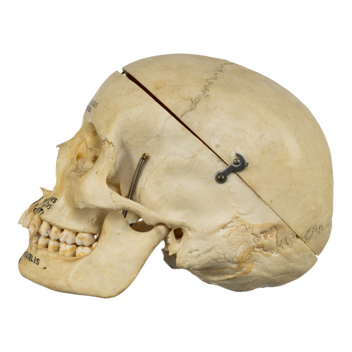 Real Human Painted Skull in Carrying Case