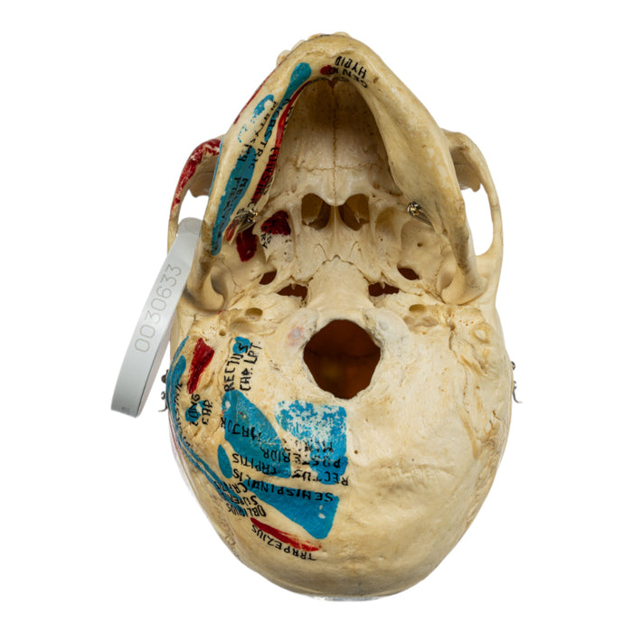 Real Human Painted Skull in Carrying Case