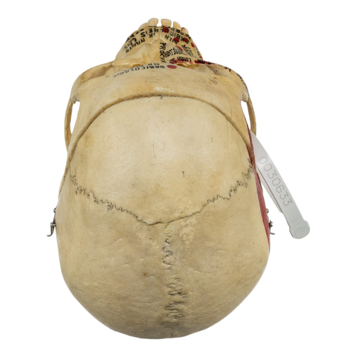 Real Human Painted Skull in Carrying Case
