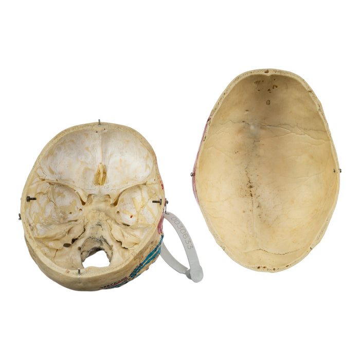 Real Human Painted Skull in Carrying Case