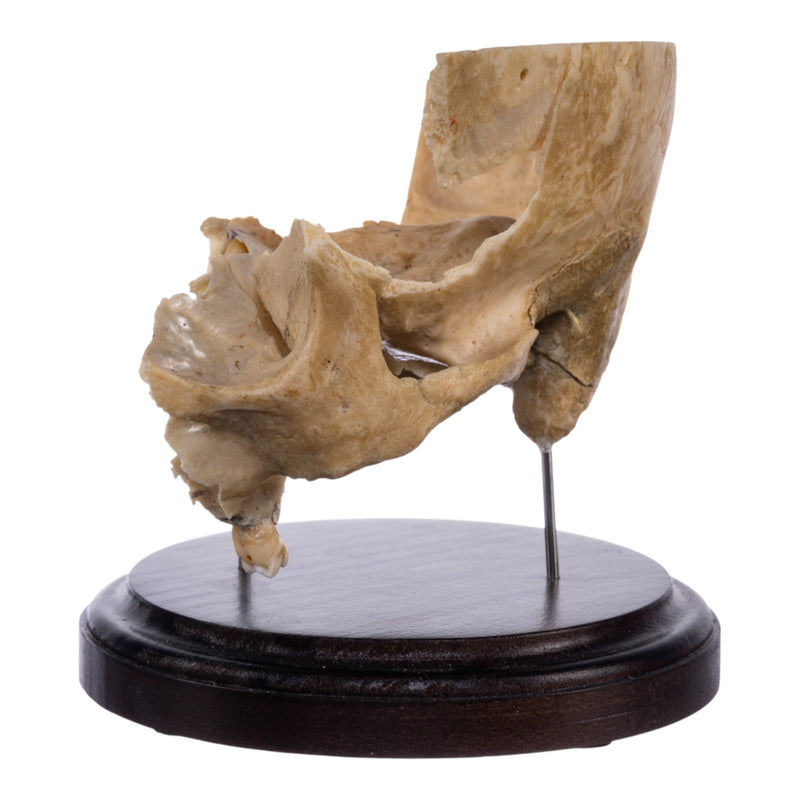 Real Human Partial Skull on Stand
