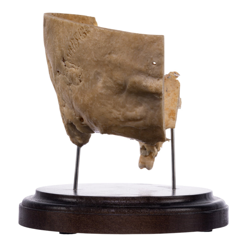 Real Human Partial Skull on Stand