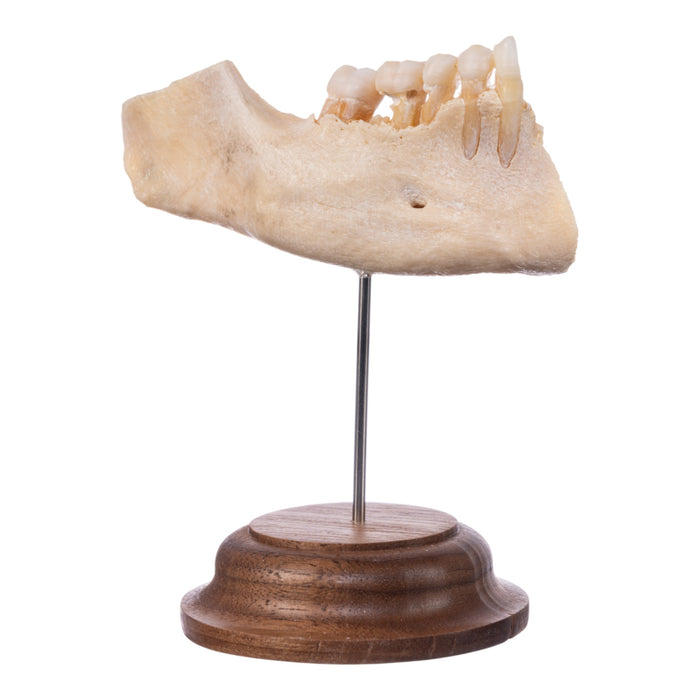 Real Human Partial Mandible On Stand